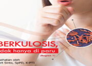 Ribuan Kasus Ditemukan, Kota Padang Sedang Tidak Baik Terhadang Penyakit TBC